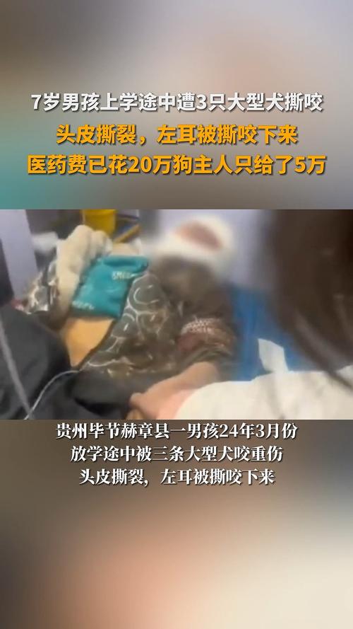 去澳门读研究生需要什么条件和7岁男孩遭3只犬撕咬与7岁男孩遭3只犬撕咬怎么办