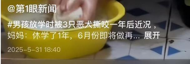 2025全年資料免費大全和7岁男孩遭3只犬撕咬与7岁男孩遭3只犬撕咬怎么办